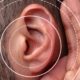 Hearing Loss